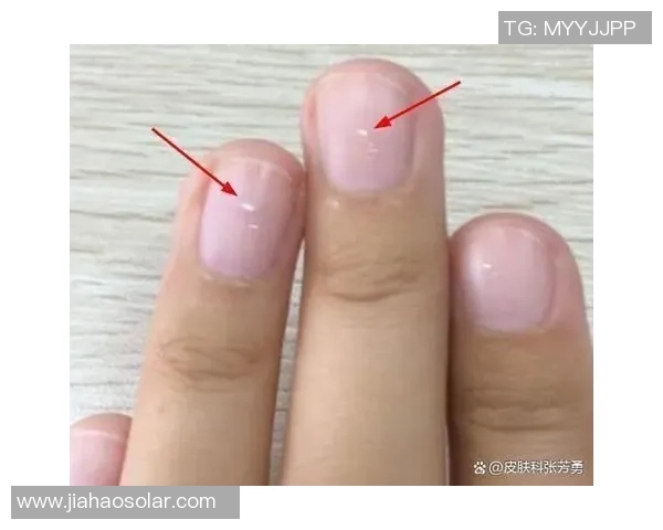 小孩指甲中间裂开的原因及护理方法详解 小孩指甲中间裂开的原因及护理方法详解